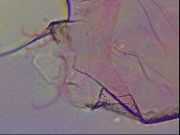 Haplomacrobiotus hermosillensis image