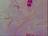 Haplomacrobiotus hermosillensis image