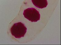 Haplomacrobiotus hermosillensis image