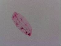 Haplomacrobiotus hermosillensis image