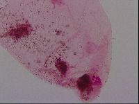 Haplomacrobiotus hermosillensis image