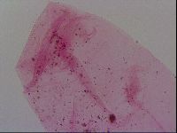 Haplomacrobiotus hermosillensis image