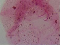 Haplomacrobiotus hermosillensis image