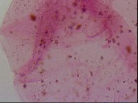 Haplomacrobiotus hermosillensis image