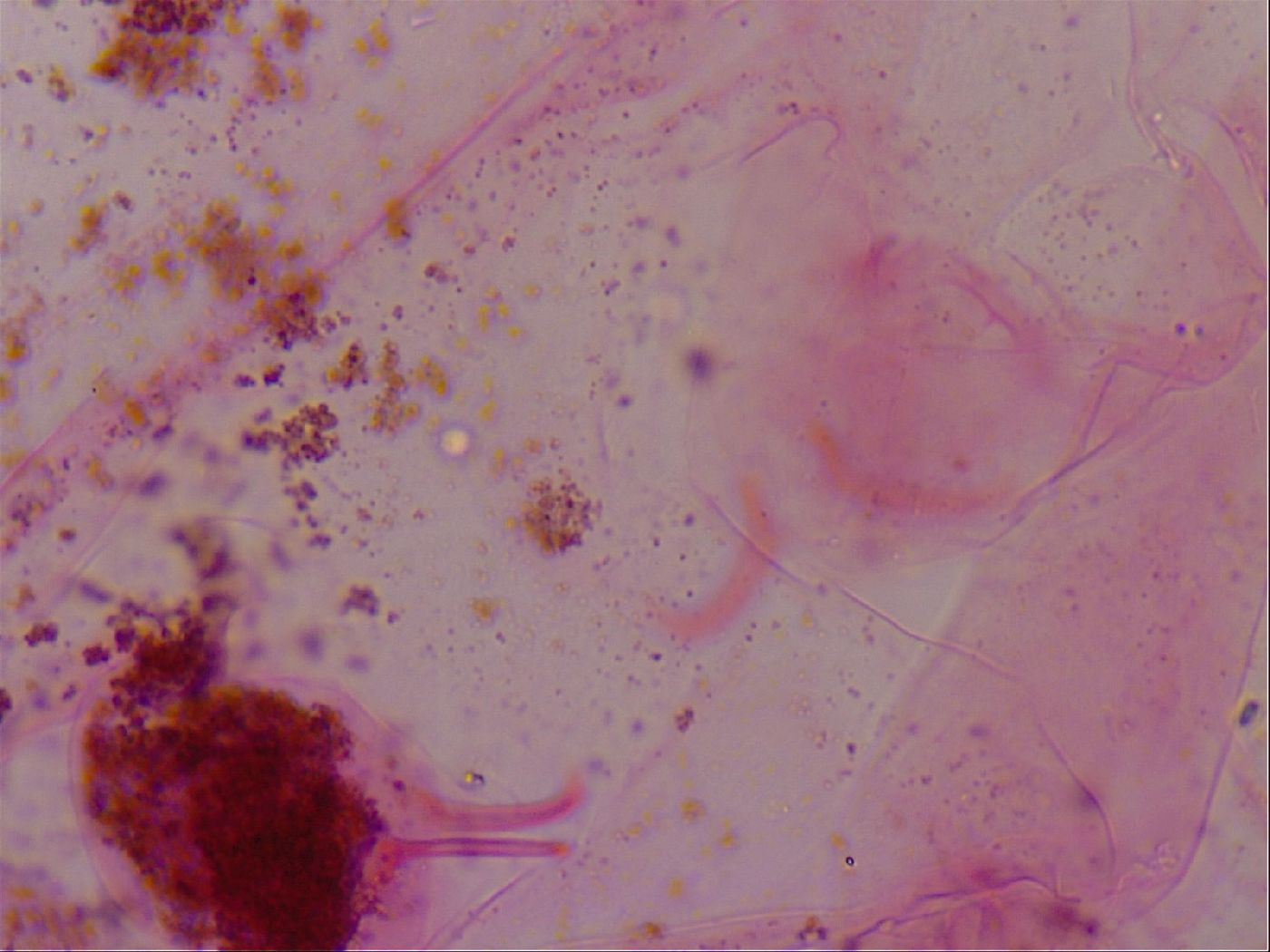 Haplomacrobiotus hermosillensis image