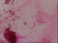 Haplomacrobiotus hermosillensis image
