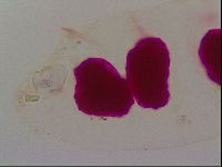 Haplomacrobiotus hermosillensis image