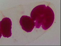 Haplomacrobiotus hermosillensis image
