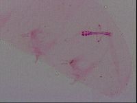 Haplomacrobiotus hermosillensis image