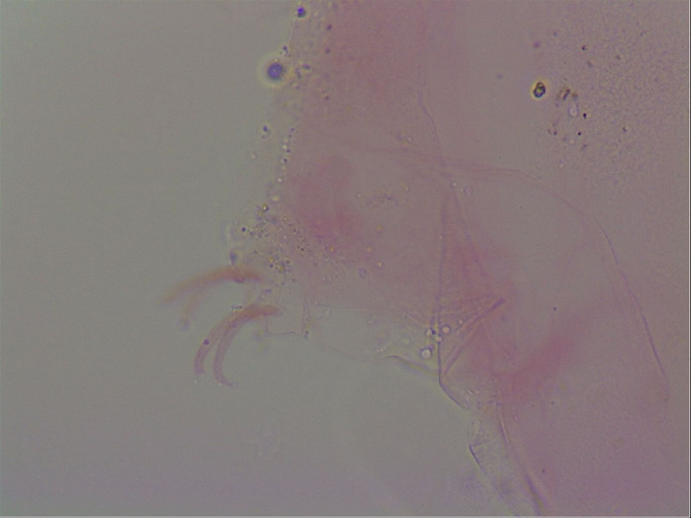 Haplomacrobiotus image