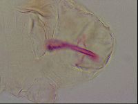 Haplomacrobiotus hermosillensis image