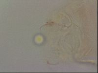 Haplomacrobiotus hermosillensis image