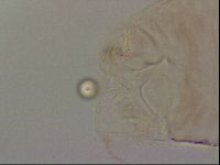 Haplomacrobiotus hermosillensis image