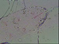 Haplomacrobiotus hermosillensis image