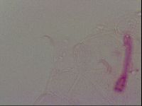 Haplomacrobiotus hermosillensis image