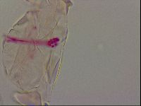 Haplomacrobiotus hermosillensis image