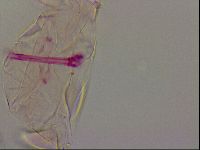 Haplomacrobiotus hermosillensis image