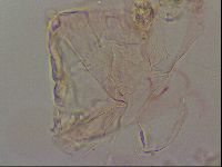 Haplomacrobiotus hermosillensis image