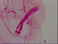 Haplomacrobiotus hermosillensis image