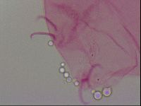 Haplomacrobiotus hermosillensis image