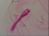 Haplomacrobiotus hermosillensis image