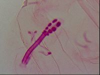 Haplomacrobiotus hermosillensis image
