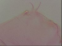 Media resource of Haplomacrobiotus hermosillensis