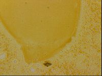 Haplomacrobiotus hermosillensis image
