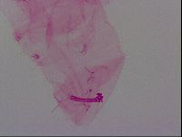 Haplomacrobiotus hermosillensis image