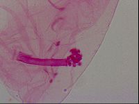 Haplomacrobiotus hermosillensis image