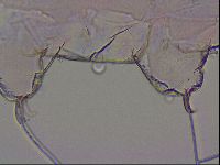 Haplomacrobiotus hermosillensis image