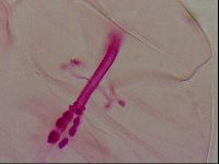 Haplomacrobiotus hermosillensis image
