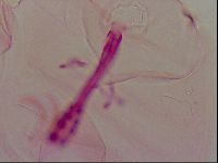 Haplomacrobiotus hermosillensis image