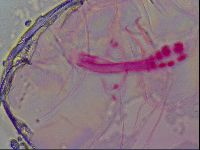 Haplomacrobiotus hermosillensis image