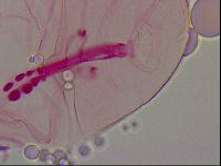 Haplomacrobiotus hermosillensis image