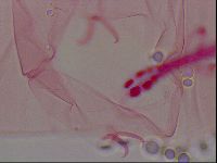 Haplomacrobiotus hermosillensis image