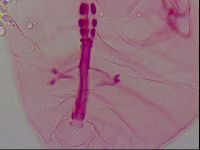 Haplomacrobiotus hermosillensis image