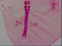 Haplomacrobiotus hermosillensis image