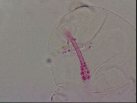 Haplomacrobiotus hermosillensis image