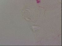 Haplomacrobiotus hermosillensis image