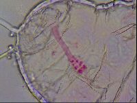 Haplomacrobiotus hermosillensis image