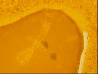 Haplomacrobiotus hermosillensis image