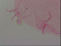 Haplomacrobiotus hermosillensis image