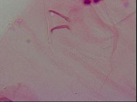 Haplomacrobiotus hermosillensis image