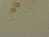 Haplomacrobiotus hermosillensis image