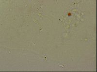 Haplomacrobiotus hermosillensis image