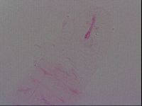 Haplomacrobiotus hermosillensis image