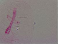 Haplomacrobiotus hermosillensis image