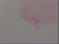 Haplomacrobiotus hermosillensis image