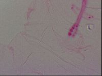 Haplomacrobiotus hermosillensis image